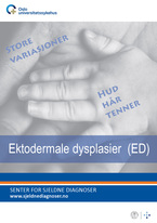 Forside diagnosefolder ektodermale dysplasier Forside diagnosefolder ektodermale dysplasier