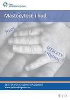 Forside diagnosefolder mastocytose i hud Forside diagnosefolder mastocytose i hud