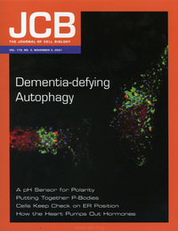 <i>Cover caption from JCB:</i> <br>Protein deposits (red) are not cleaned up in autophagy-deficient cells. This might lead to dementia, say Filimenko et al.(click to enlarge) <i>Cover caption from JCB:</i> <br>Protein deposits (red) are not cleaned up in autophagy-deficient cells. This might lead to dementia, say Filimenko et al.(click to enlarge)