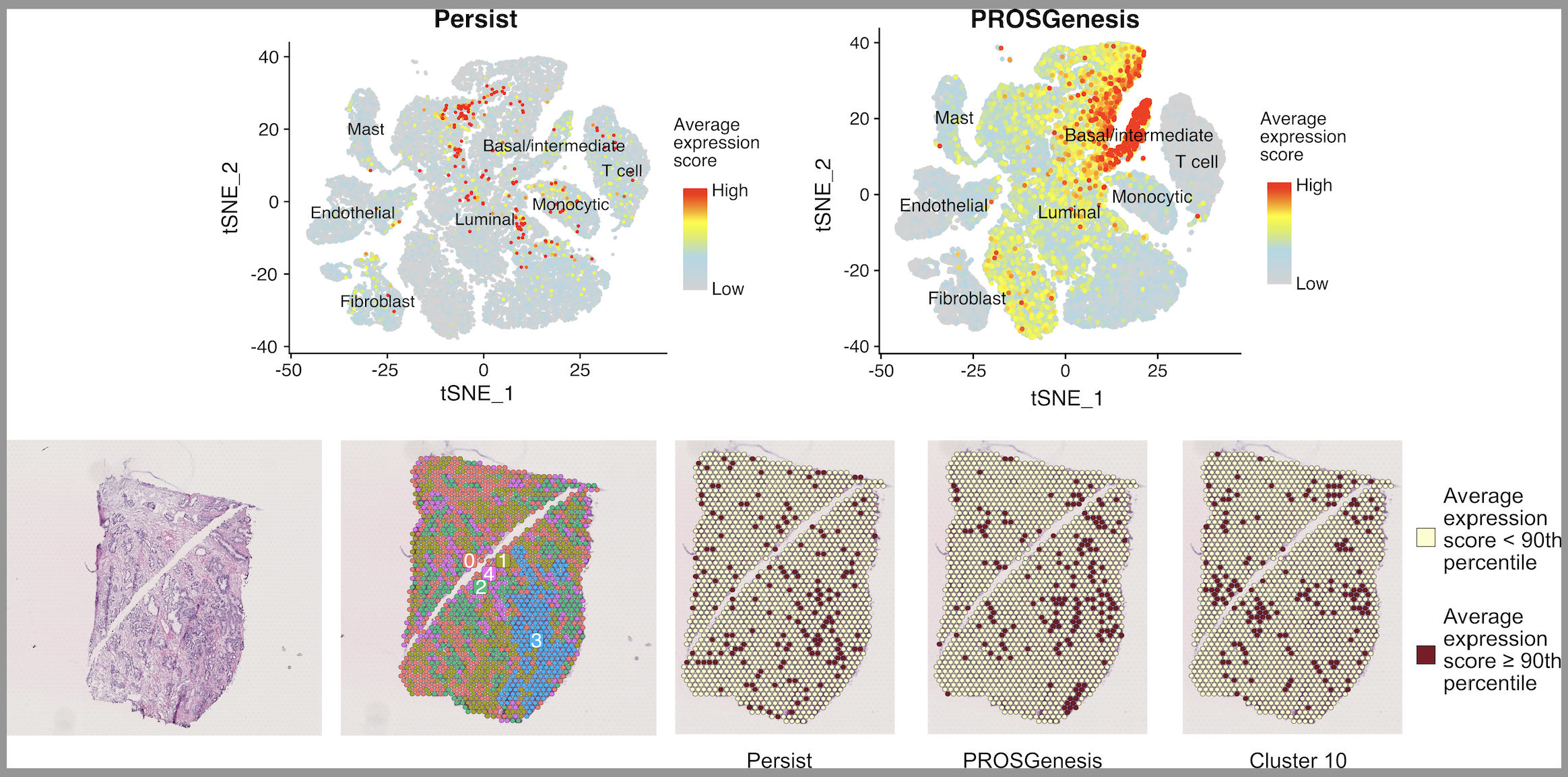 Single-cell level regenerative (PROSGenesis) and stem-like (Persist) gene patterns identified in prostate specimens