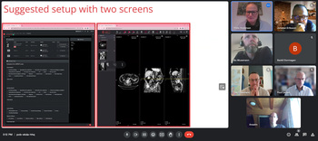 DETECT Acute: Kick Off online