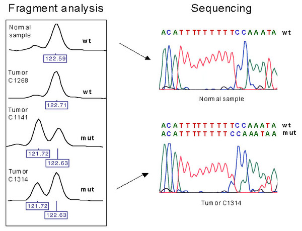 We recently identified frame-shift mutations in a novel target gene, WISP-3, in colorectal carcinomas with microsatellite instability (Thorstensen et al., 2001, Gastroenterology). Tumors C1141 and C1314 reveal heterozygous mutations in WISP-3. The box to the left illustrates analyses of the PCR products on an ABI PRISMTM310 Genetic Analyzer (the number in the blue boxes indicate the size of the PCR products), whereas the sequenced PCR products are shown to the right. Wt; wild type, mut; mutation.