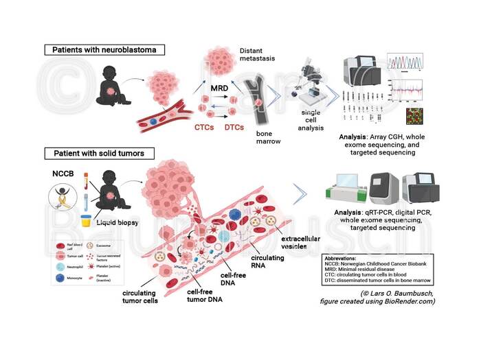 Circulating molecular structures are detected in different body fluids of patients diagnosed with solid tumors. 
Researchers investigate these components in a procedure called liquid biopsy for increased detection, prognosis, and monitoring of cancer. 
(© LOB, created with BioRender.com).