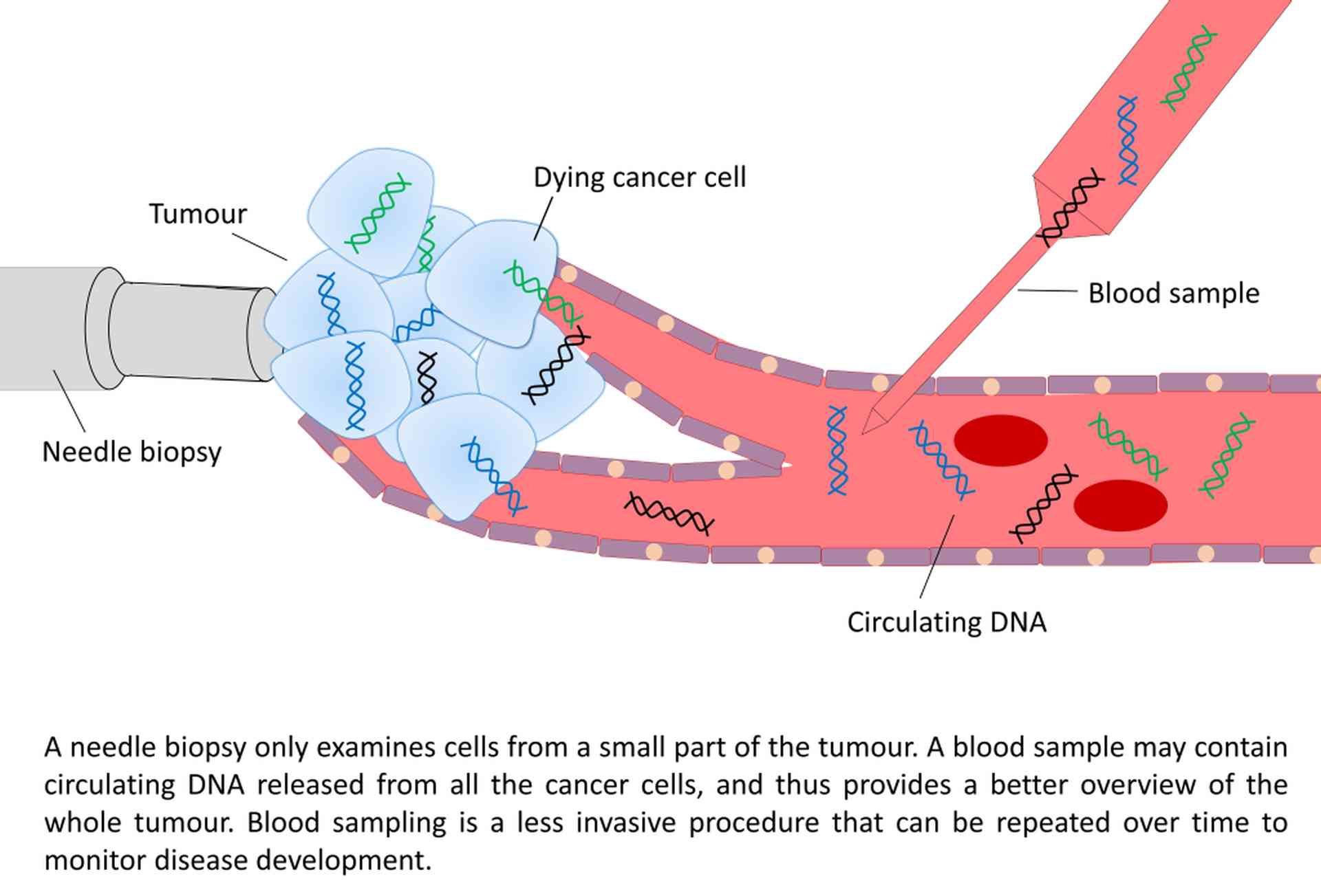 Liquid biopsy